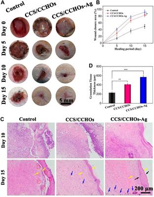 Antibacterial Cellulose Nanocrystal-Incorporated Hydrogels With Satisfactory Vascularization for Enhancing Skin Regeneration